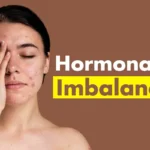Hormone Imbalance: Causes, Symptoms, Treatment, and Natural Ways to Restore Balance